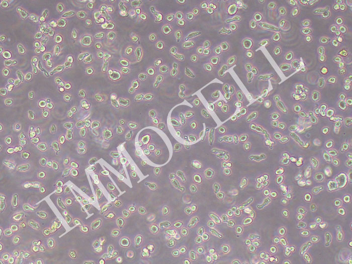 LP-1人多发性骨髓瘤（浆细胞骨髓瘤）