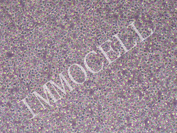 OCI-LY1人B细胞淋巴瘤细胞（STR鉴定正确）