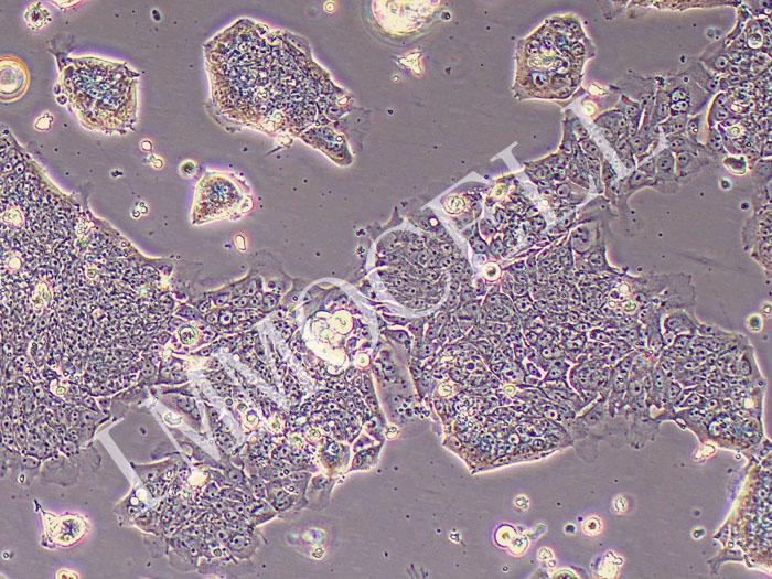 T84人结肠腺癌肺转移细胞（STR鉴定正确）
