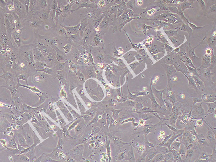 HIBEpiCs-SV40T人肝内胆管上皮细胞永生化