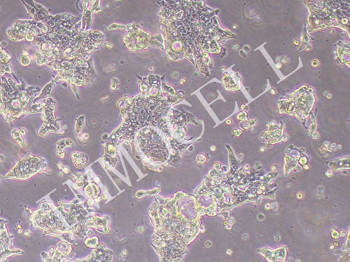 CL-40人结肠癌细胞（STR鉴定正确）