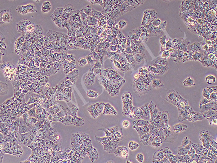 HuH-7人肝癌细胞（STR鉴定正确）