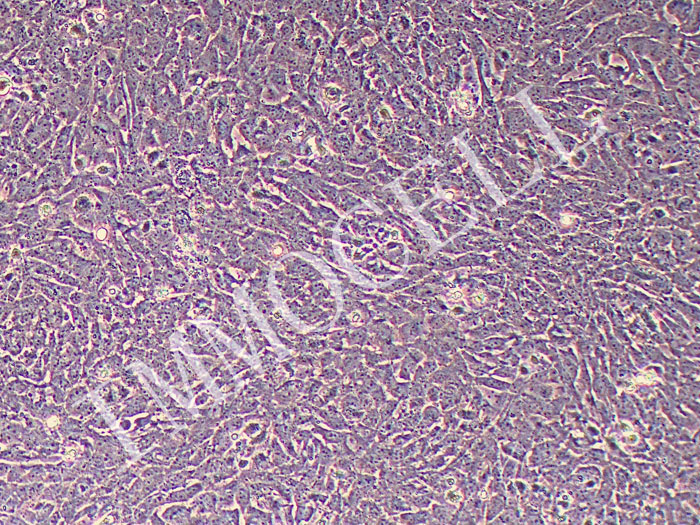 小鼠淋巴管内皮细胞永生化