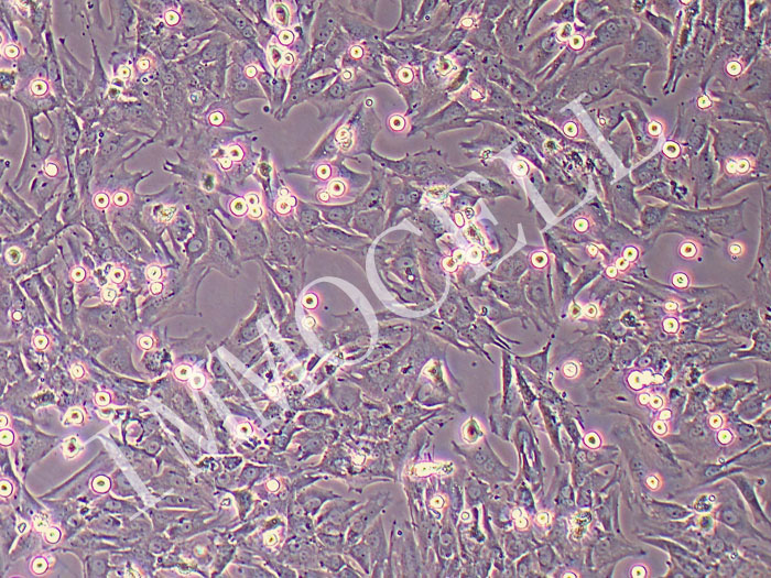 大鼠静脉平滑肌细胞永生化