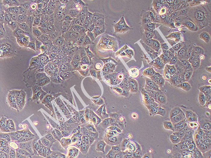 HPAF-II人胰腺癌细胞（STR鉴定正确）