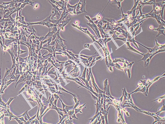 小鼠心肌成纤维细胞永生化（物种鉴定正确）