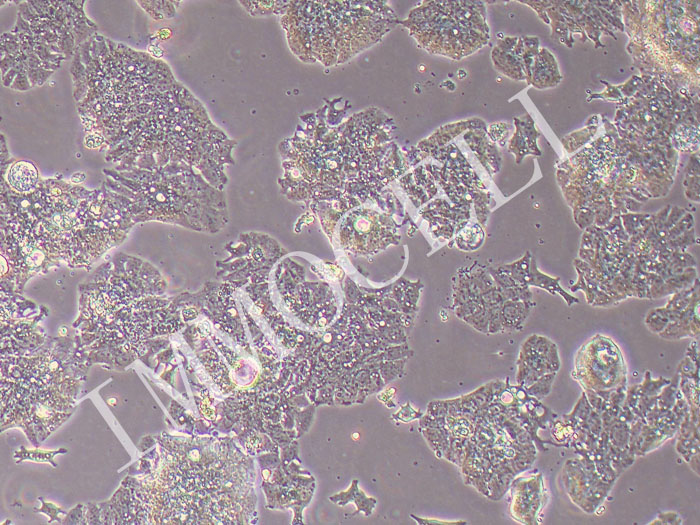 LS1034人结肠腺癌细胞（STR鉴定正确）