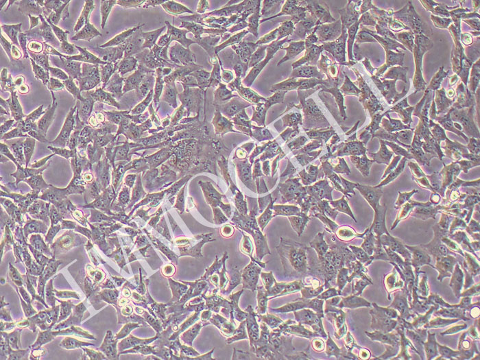 SCC7小鼠头颈鳞癌细胞系（STR鉴定正确）