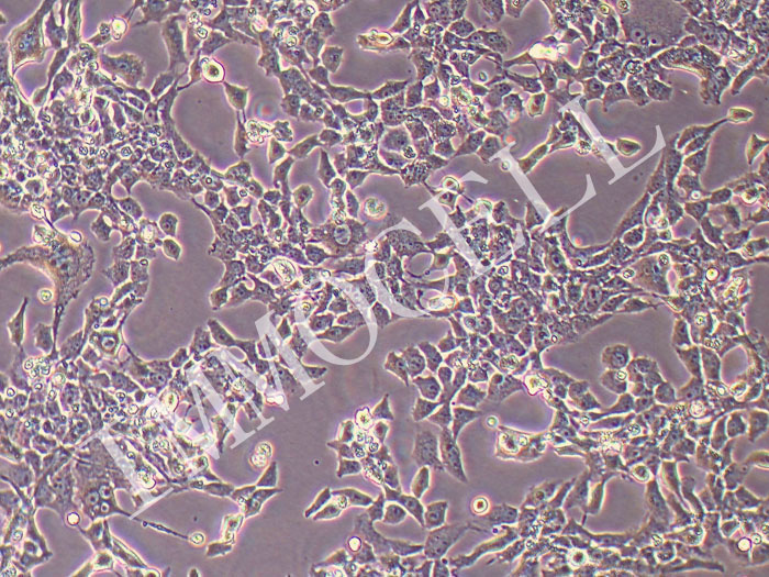 BICR-31人舌鳞状细胞癌