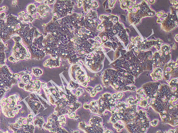 Ls513人结直肠癌细胞（STR鉴定正确）
