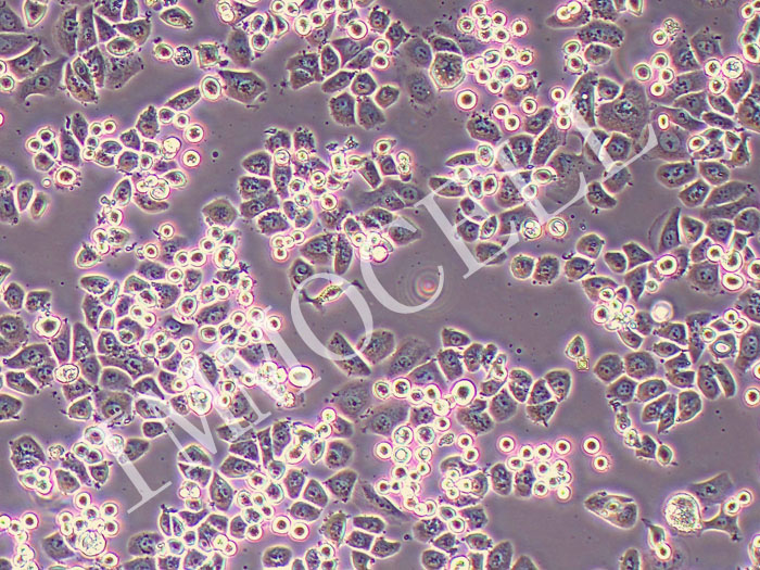 SK-BR-3人乳腺腺癌细胞（STR鉴定正确）