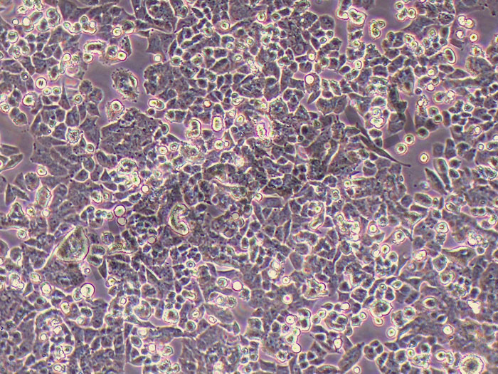 CHC-X1人混合型肝癌细胞