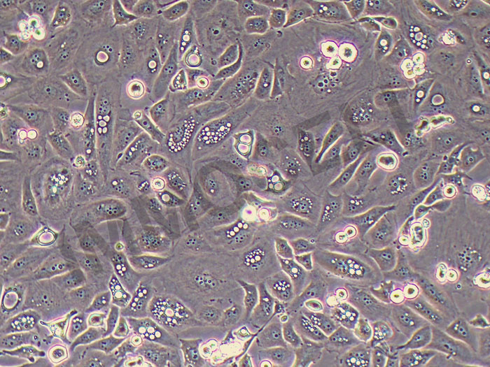 GBC-X1人胆囊癌细胞（STR鉴定正确）