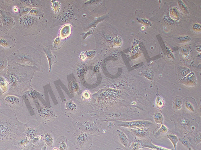 Hep-X1人肝癌细胞（STR鉴定正确）