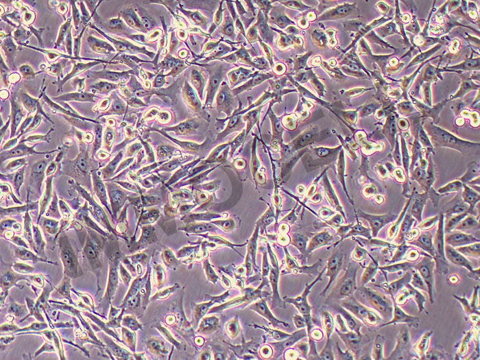 ICC-X2人肝内胆管癌细胞