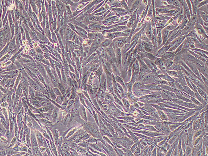 ICC-X3人肝内胆管癌细胞