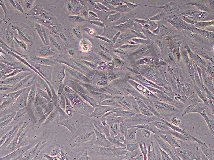 PDAC-X3人胰腺癌细胞（STR鉴定正确）