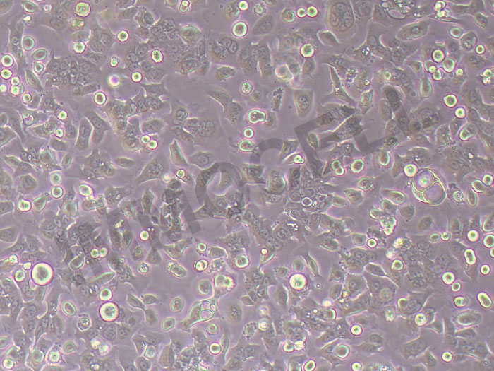 PDAC-X2人胰腺癌细胞
