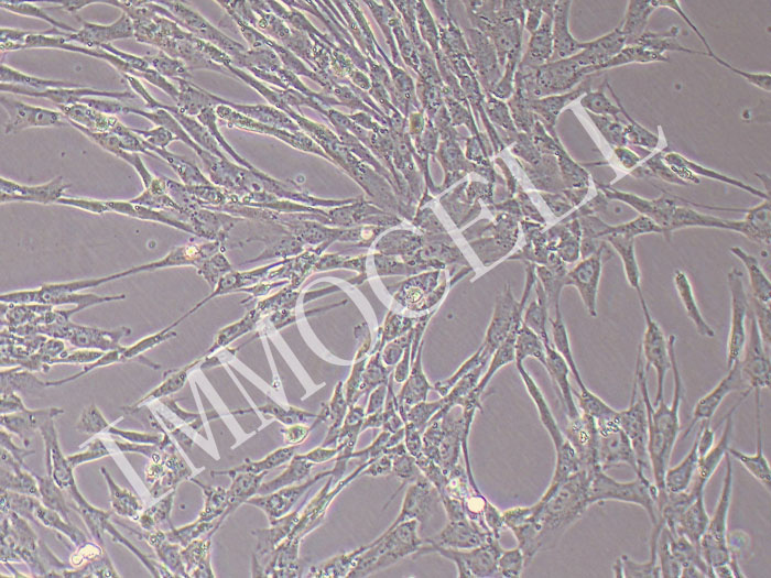 人牙龈成纤维细胞永生化