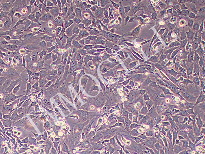 小鼠髁突软骨细胞永生化（物种鉴定正确）