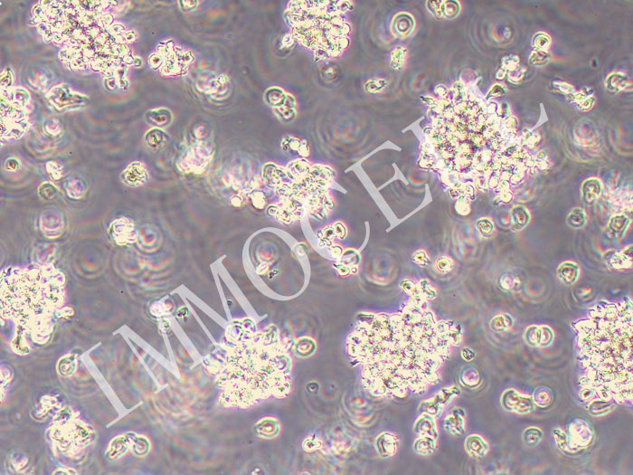 KHYG-1人NK细胞淋巴瘤细胞