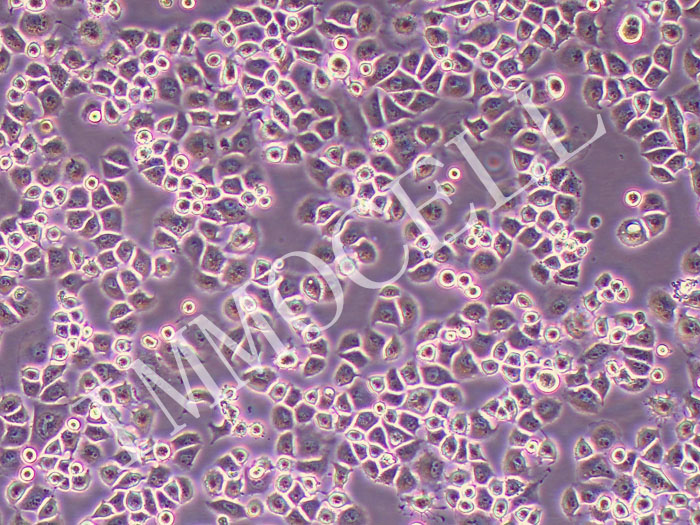 U14-FLUC-PURO小鼠子宫颈癌细胞-FLUC标记-puro抗性（STR鉴定正确）