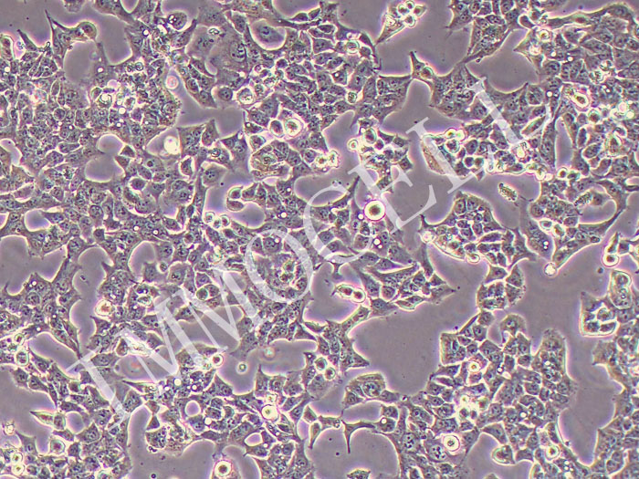 KYSE-70人食管鳞状细胞癌细胞（STR鉴定正确）
