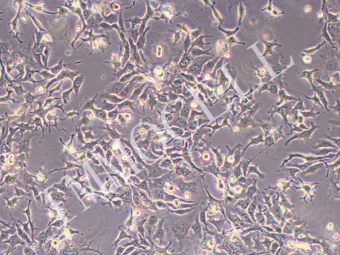 NCI-H1568人非小细胞肺腺癌细胞（STR鉴定正确）