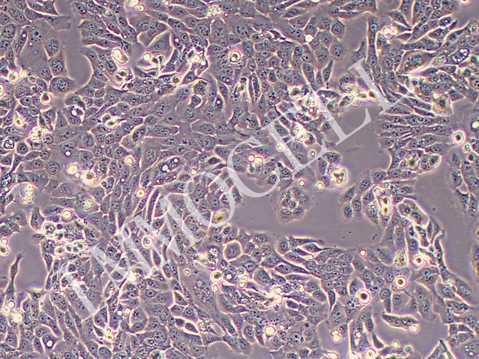 SNU-C5人结直肠腺癌细胞（STR鉴定正确）