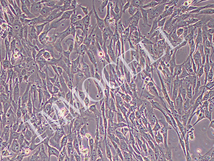 人滑膜成纤维细胞永生化