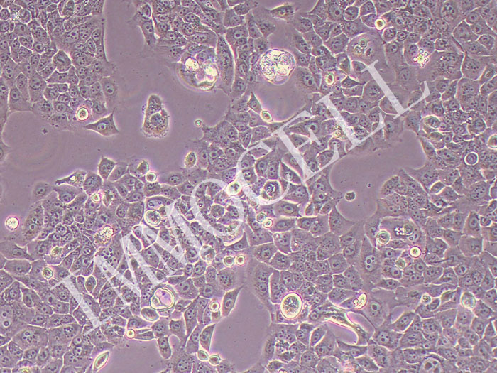 BFTC-905人膀胱癌细胞（STR鉴定正确）