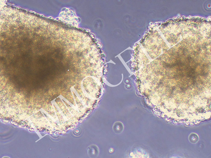NCI-H1436人小细胞肺癌（STR鉴定正确）