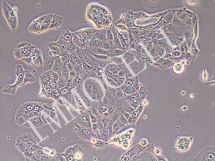 HT-1197人膀胱癌细胞（STR鉴定正确）