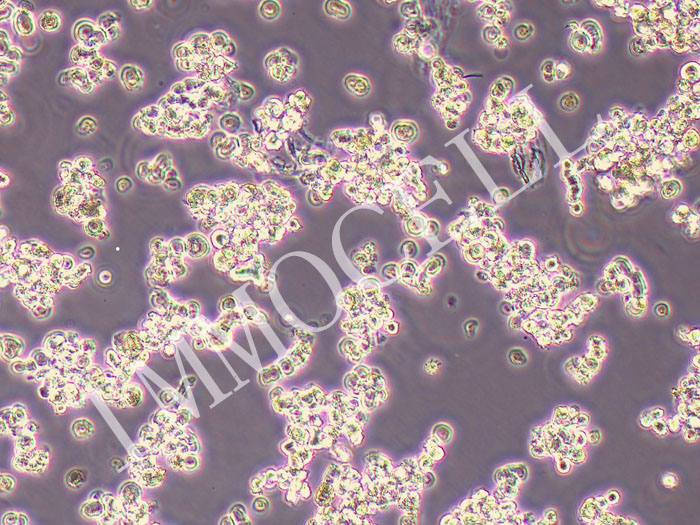 DMS-79人小细胞肺癌细胞（STR鉴定正确）