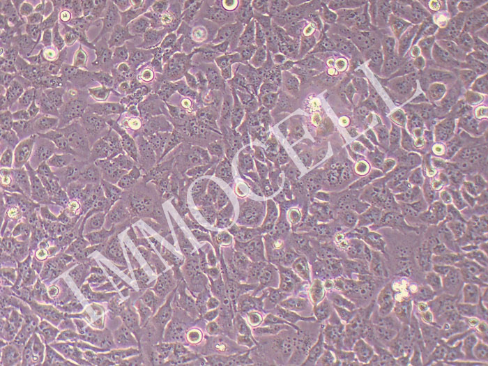 TTA1人甲状腺癌细胞（未分化）（STR鉴定正确）