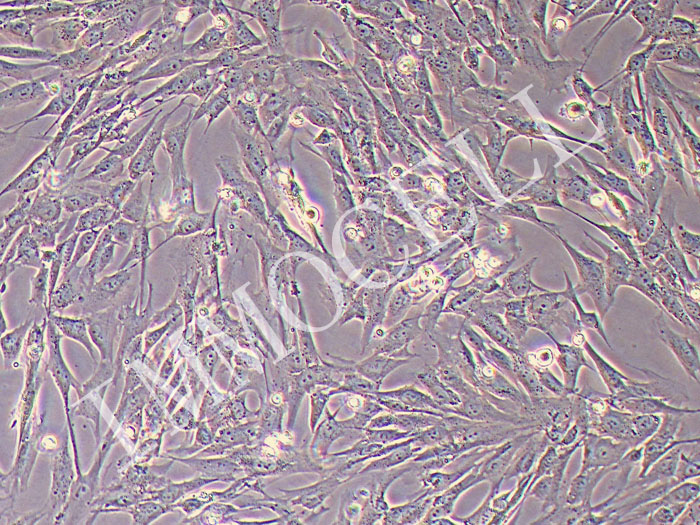 人结肠癌成纤维细胞永生化