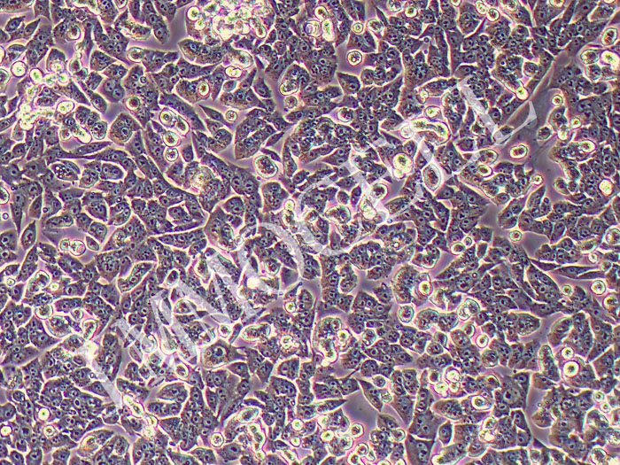 MOC1小鼠口腔鳞状细胞癌细胞（种属鉴定）