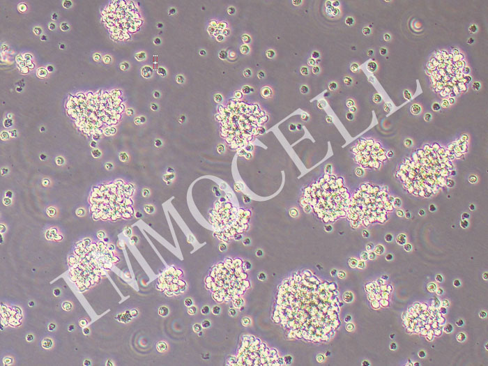 OCI-LY7人弥漫大B细胞淋巴瘤细胞（STR鉴定正确）