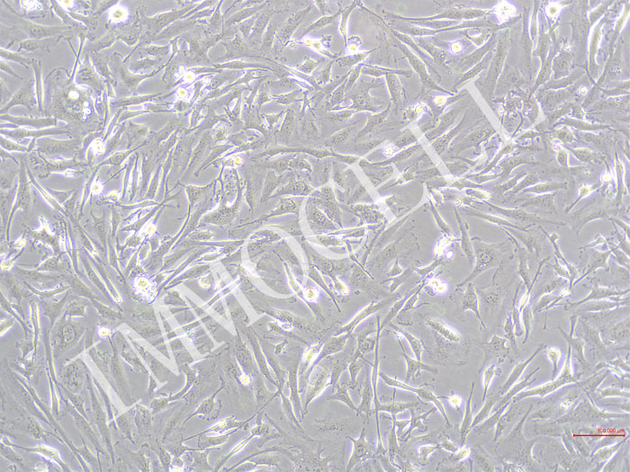 ICC-X1-Fluc-puro人肝内胆管癌细胞