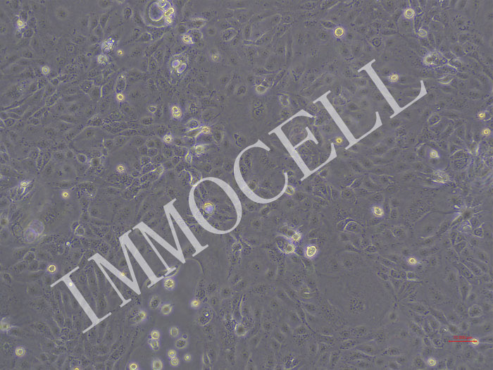 PDAC-X1-Nluc-puro人胰腺癌细胞