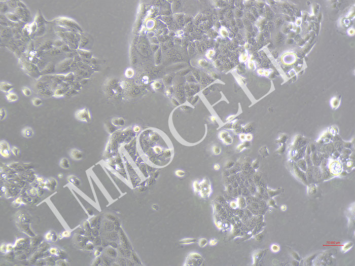 PDAC-X2-Fluc-puro人胰腺癌细胞