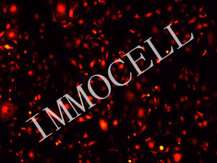 GBC-X1-mScarlet3-puro人胆囊癌细胞