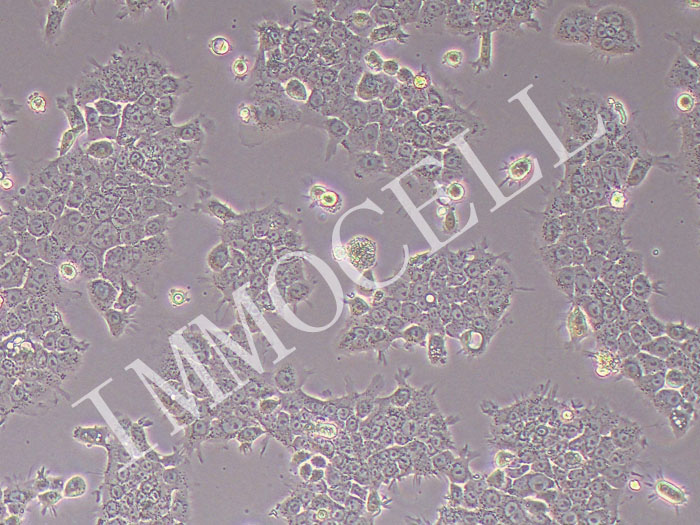 Colo-16人皮肤鳞状细胞癌细胞