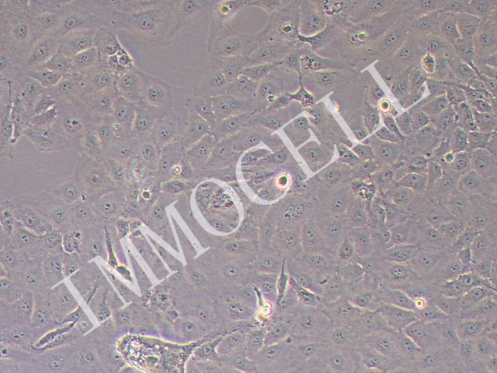 OVCA433人卵巢浆液性腺癌细胞