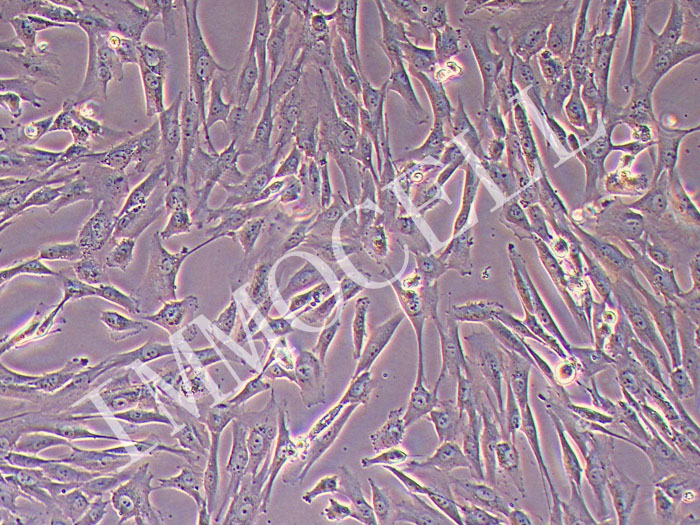 人牙髓干细胞永生化