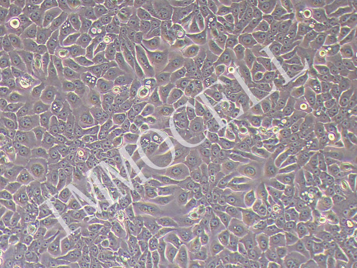 Eca-109人食管癌细胞（STR鉴定正确）