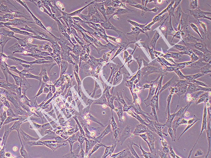人肺成纤维细胞永生化