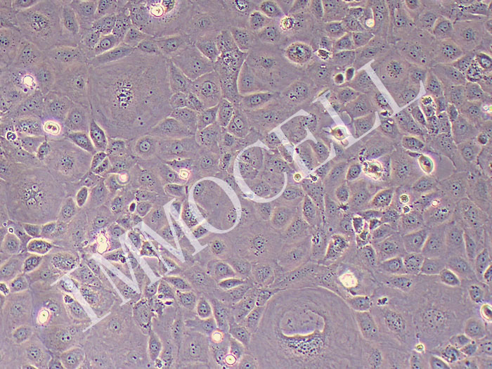 小鼠主动脉内皮细胞永生化