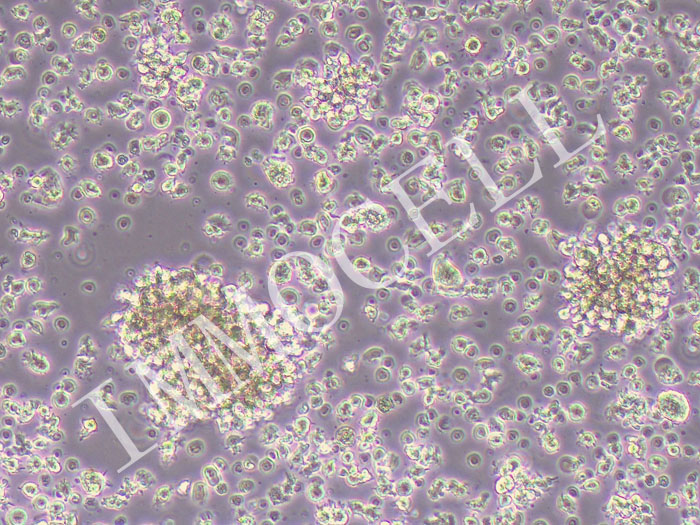 SLVL人脾淋巴瘤细胞（STR鉴定正确）