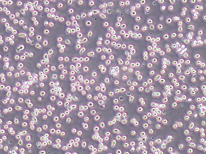 CoC1人卵巢癌细胞（STR鉴定正确）